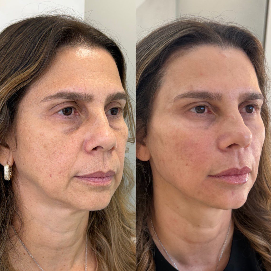Nova paciente — resultado de frente 2